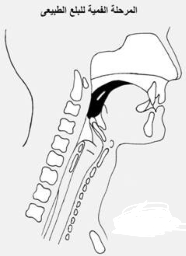 Swallowing disorder do.php?img=5769